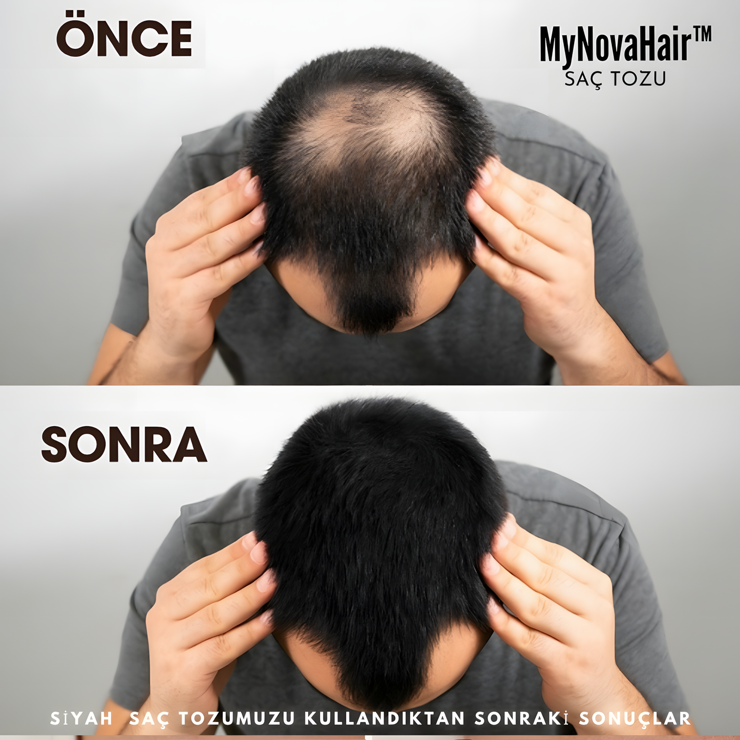 MyNovaHair™ Anında Saç Dolgunlaştırıcı Seyreklik Kapatıcı