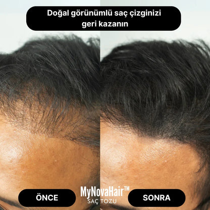 MyNovaHair™ Anında Saç Dolgunlaştırıcı Seyreklik Kapatıcı