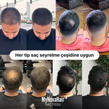 MyNovaHair™ Anında Saç Dolgunlaştırıcı Seyreklik Kapatıcı