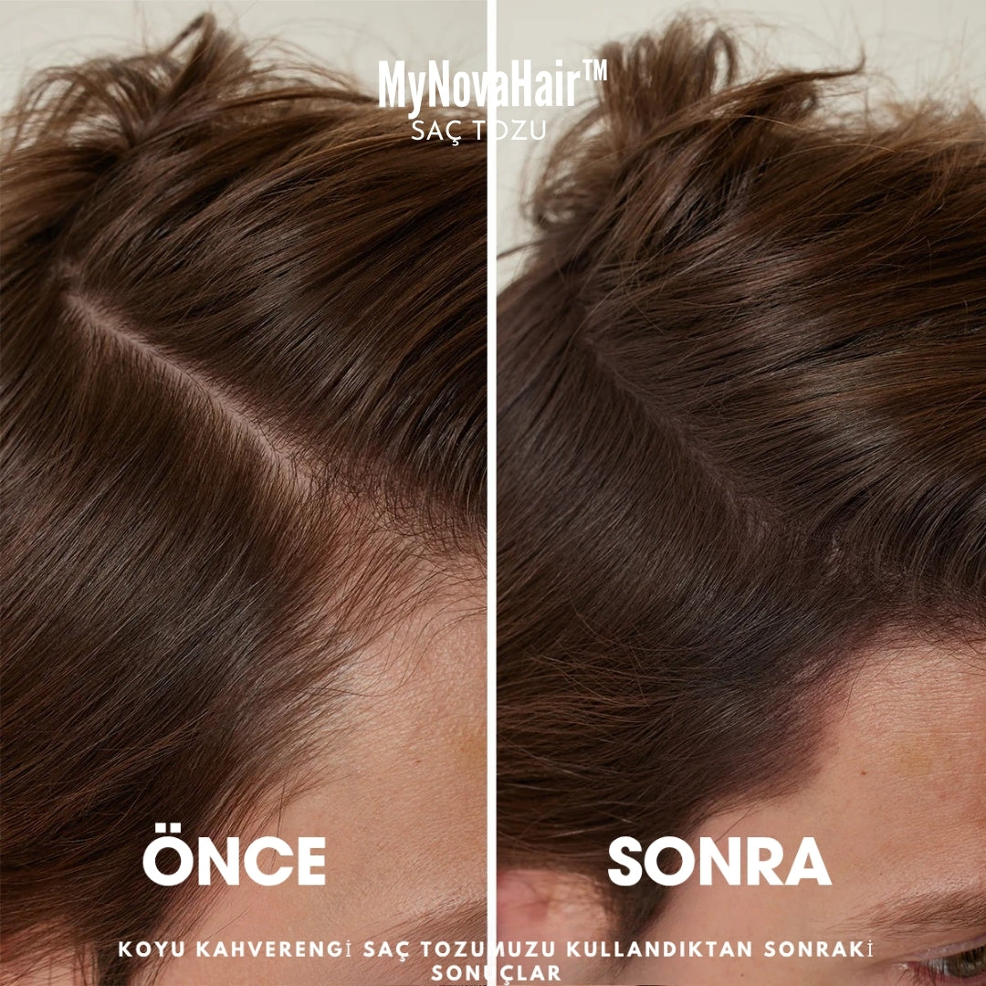 MyNovaHair™ Anında Saç Dolgunlaştırıcı Seyreklik Kapatıcı